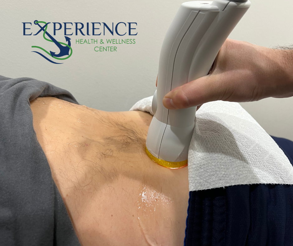 Unlocking Sciatica Pain Relief with SoftWave Tissue Regeneration Technology at Experience Health & Wellness Center in Cape Coral, FL
